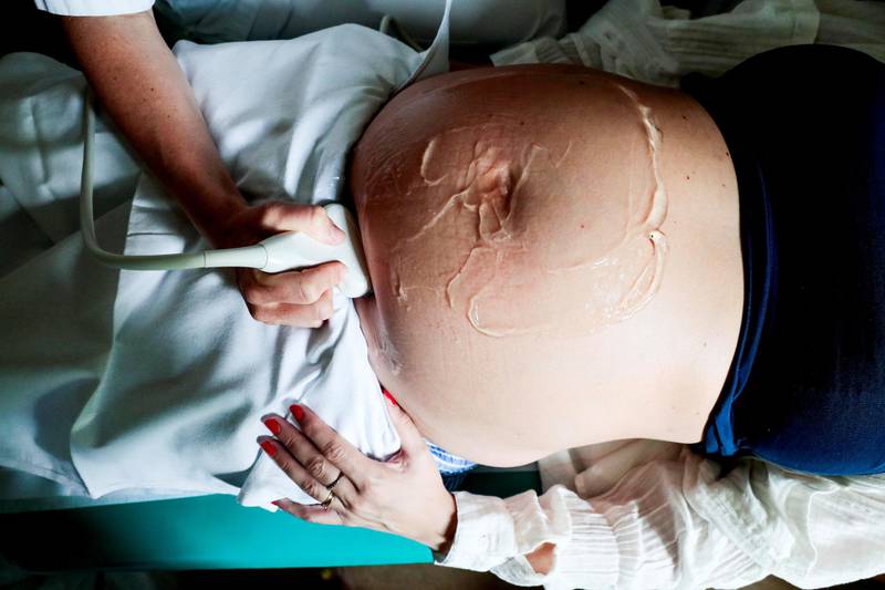 risikofylt: Det oppstår oftere komplikasjoner når mor er gravid med to eller flere barn enn med ett. ILLUSTRASJONSFOTO: LISE ÅSERUD/NTB SCANPIX