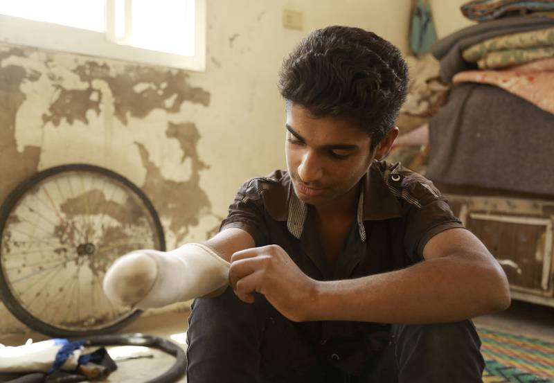 Mange barn og unge i Syria må amputere armer eller bein etter angrep i krigen. Det sjette året ble det verste i krigen, ifølge UNICEF. Dette bildet er tatt i fjor av tenåringen Bashar Qassem, som har måttet amputere armen, i byen Al-Hol.