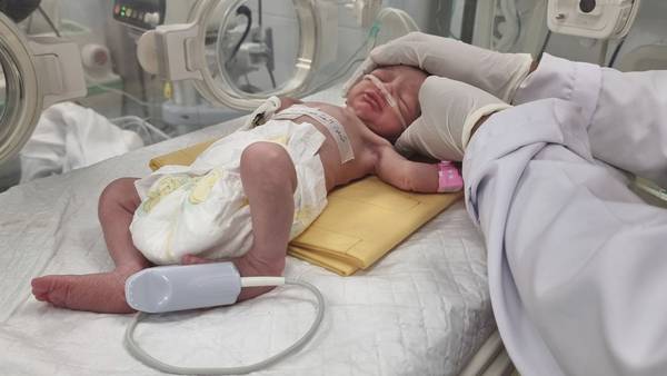 Baby reddet ut av magen til sin drepte mor i Gaza