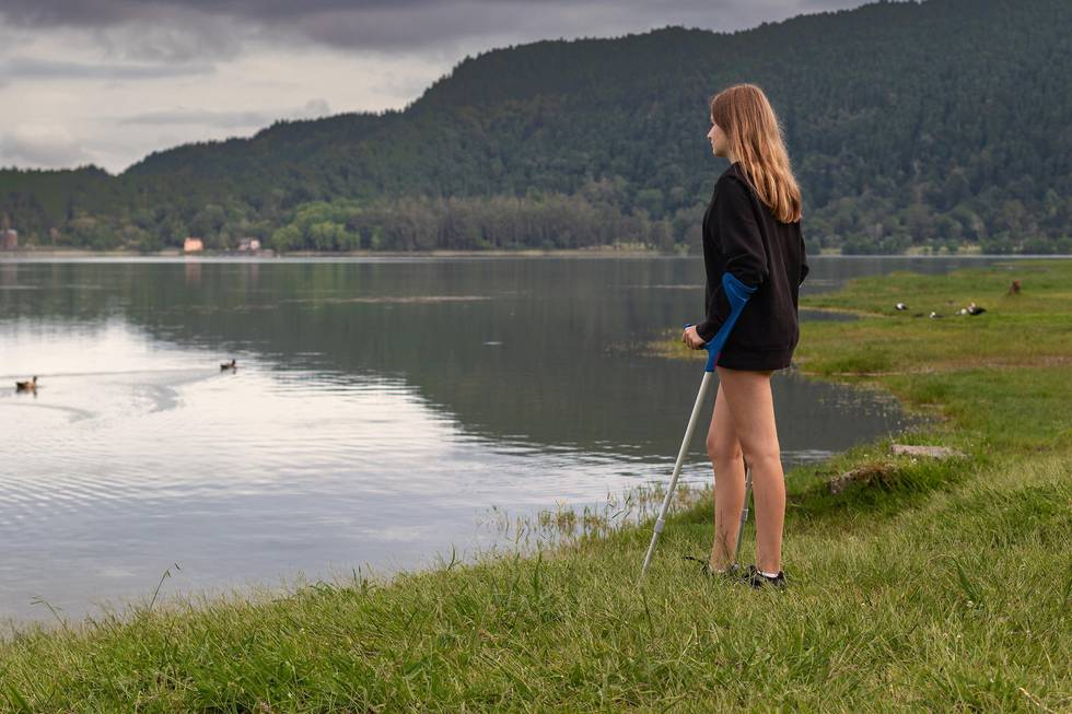 Teenage girl with a leg injury leaning on forearm crutches is standing by a lake and admiring beautiful landscape during sunset.