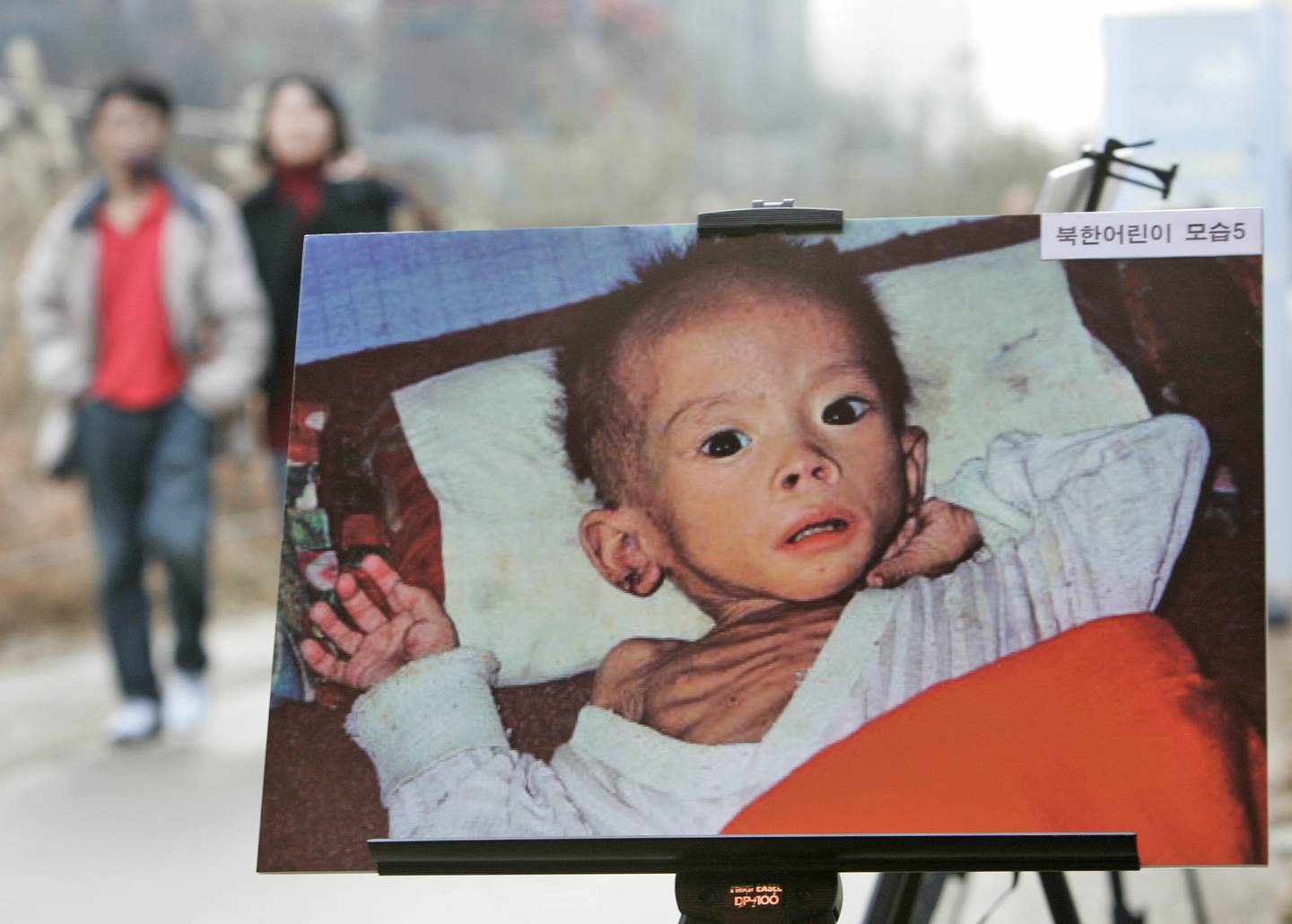 A South Korean couple passes by a photo showing a North Korean child suffering from famine during a photo exhibition held by a human rights group against North Korea,  to commemorate the 60th anniversary of the universal declaration of human rights on the street in Seoul, South Korea, Monday, Dec. 8, 2008. A United Nations committee last month approved a resolution calling for improvement in human rights in North Korea.(AP Photo/Ahn Young-joon)