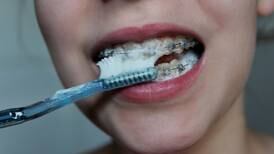 Unges tannhelse blir stadig bedre. En ting bekymrer likevel tannlegene