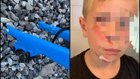 9-åring stupte rett i asfalten etter livsfarlig TikTok-utfordring