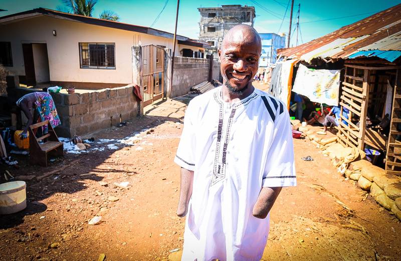 Mohamed Tarawallie leder AWWAm organisasjonen for amputerte i Sierra Leone.