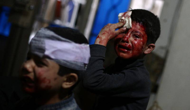 Krigens ofre: Sårede barn venter på behandling i en opprørskontrollert del av byen Douma  i mars i fjor. 