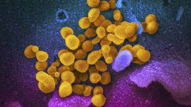Kinesisk ekspert: – Kan ikke utelukke at koronaviruset stammer fra laboratorium