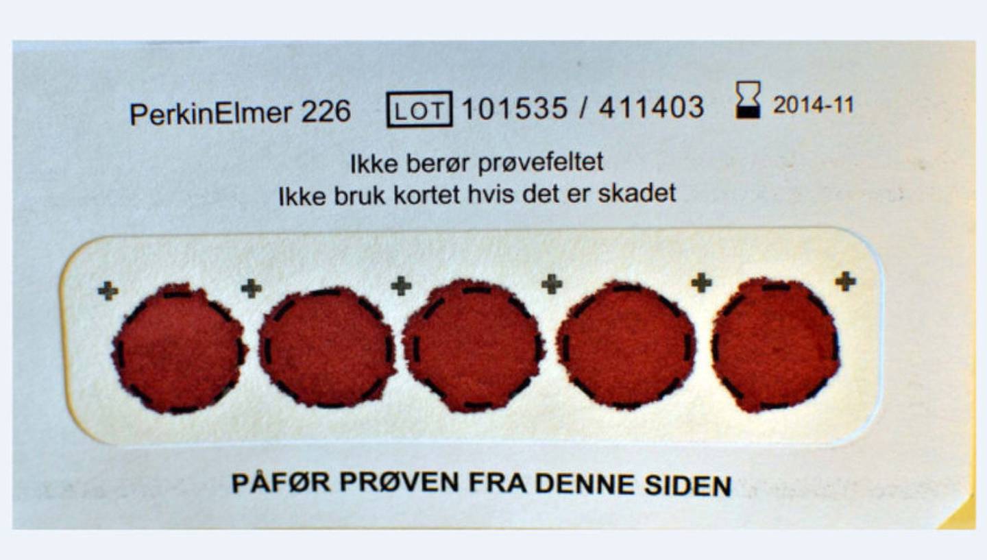 Slik er filterkortet som påføres noen dråper blod fra nyfødte, før det sendes til Nyfødtscreeeningen.