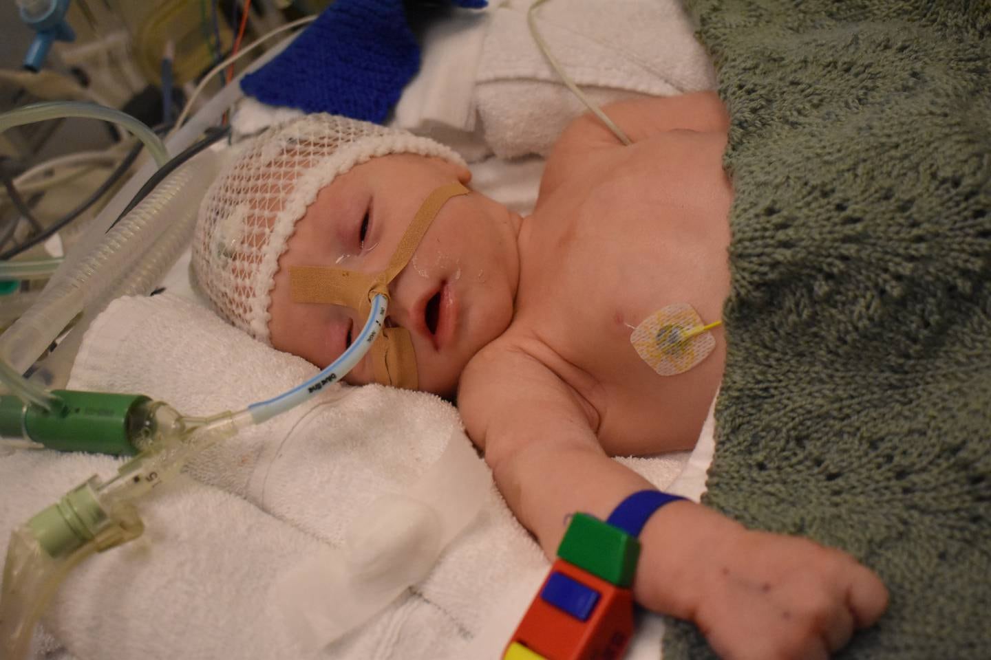 Miran Lucas koblet til respirator og fått på EEG for måling av hjerneaktivitet på neonatal avd på Ålesund Sykehus.