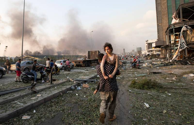People evacuate wounded after of a massive explosion in Beirut, Lebanon, Tuesday, Aug. 4, 2020. (AP Photo/Hassan Ammar)