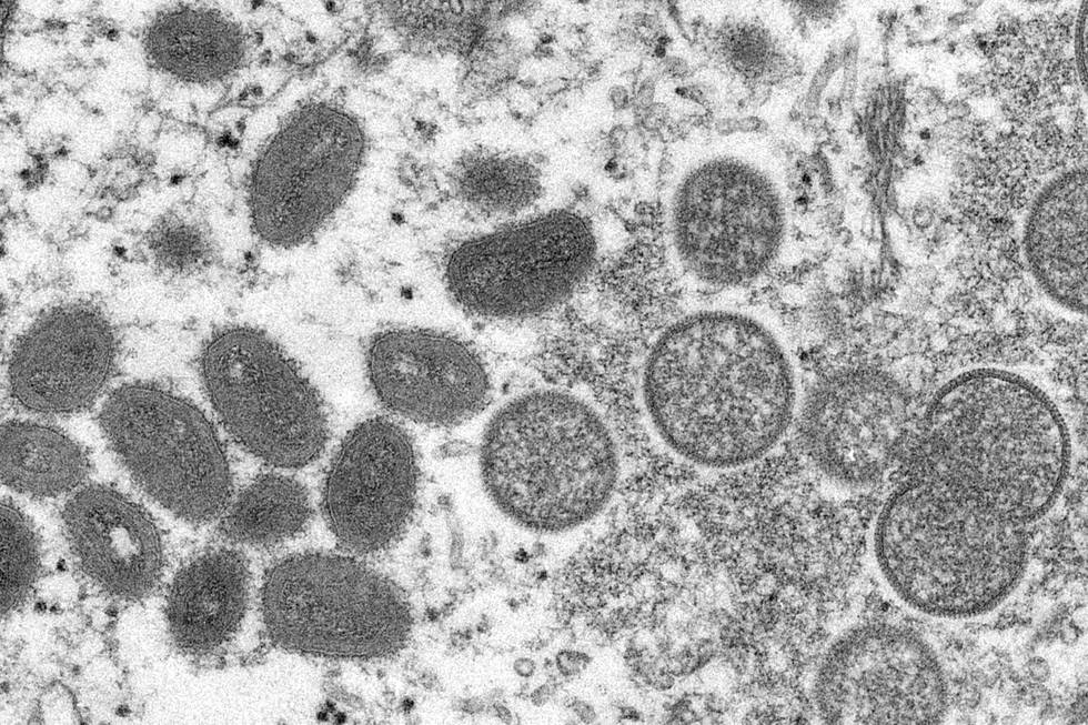 Dette mikroskop-bildet viser forskjellige typer apekopp-virus. Foto: Cynthia S. Goldsmith / Russell Regner / CDC / AP / NTB