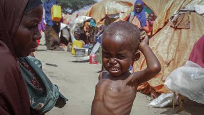 Hvert femte barn i Somalia risikerer sultedøden