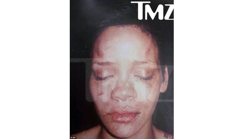 Slik så Rihanna ut etter mishandlingen i 2009. FOTO: NTB scanpix/AP Photo/TMZ