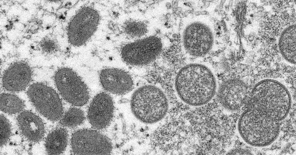Sweden classifies monkeypox as a dangerous disease for the public – Dagsavisen