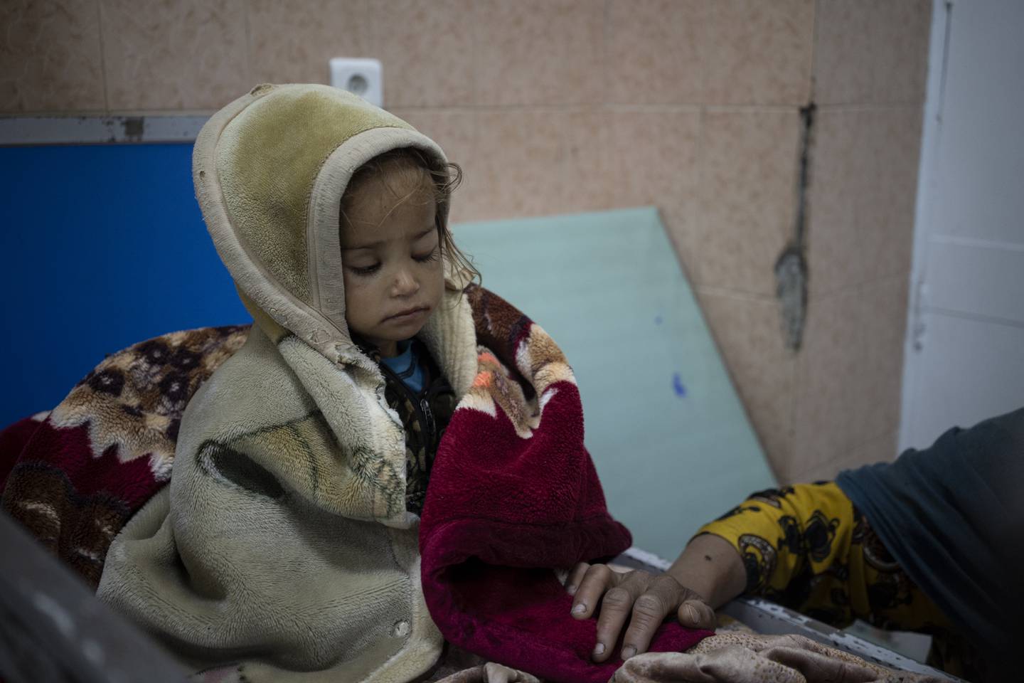 To år gamle Guldana, som er feilernært, sitter på en seng på et sykehus i Kabul.