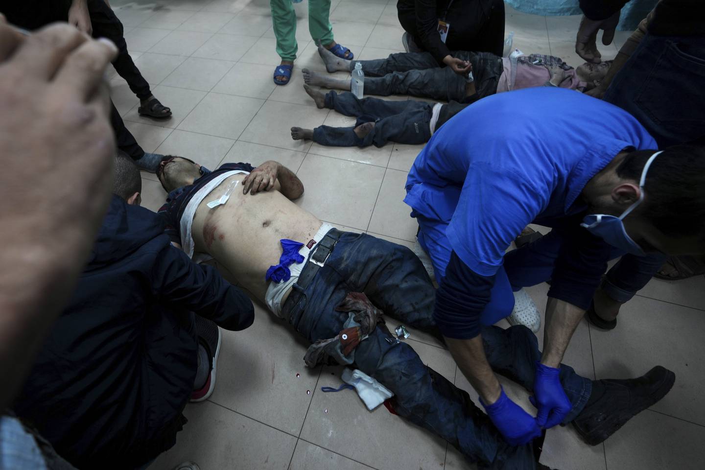 Palestinere som ble såret i det israelske bombardementet av Gaza-stripen blir brakt til sykehuset i Deir al Balah.