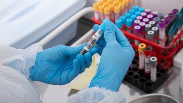 Ny studie: Blodprøve kan bidra til raskere kreftdiagnose
