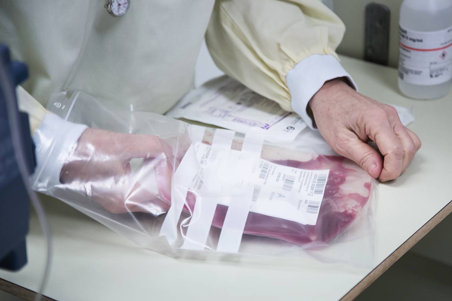 Bildet viser helsepersonell som er i ferd med å foreta en stamcelletransplantasjon ved Haukeland universitetssykehus.