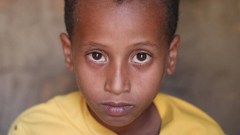 Zaid (9) mistet beinet krigen i Jemen.