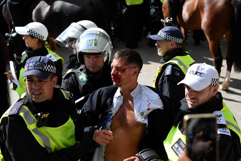 A wounded member of a far-right group is escorted by British police officers in riot gear, during scuffles as they try to contain a protest at Trafalgar Square in central London, Saturday, June 13, 2020. British police have imposed strict restrictions on groups protesting in London Saturday in a bid to avoid violent clashes between protesters from the Black Lives Matter movement, as well as far-right groups that gathered to counter-protest. (AP Photo/Alberto Pezzali)